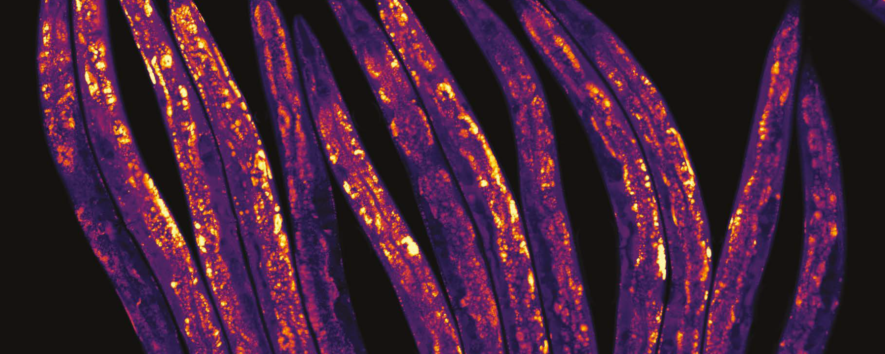 Stained C.elegans worms