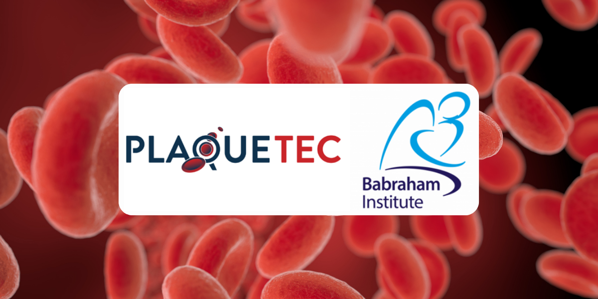 PlaqueTec and the 台湾swag 台湾swag collaborate on blood screen to improve treatment for coronary artery disease